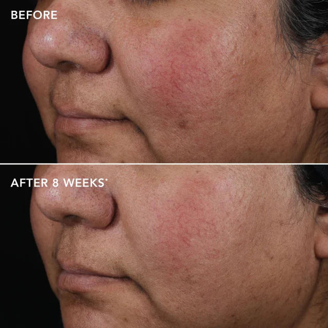 AGELESS+ Retinol Pure Liquid Retinol 0.75% Travel Size