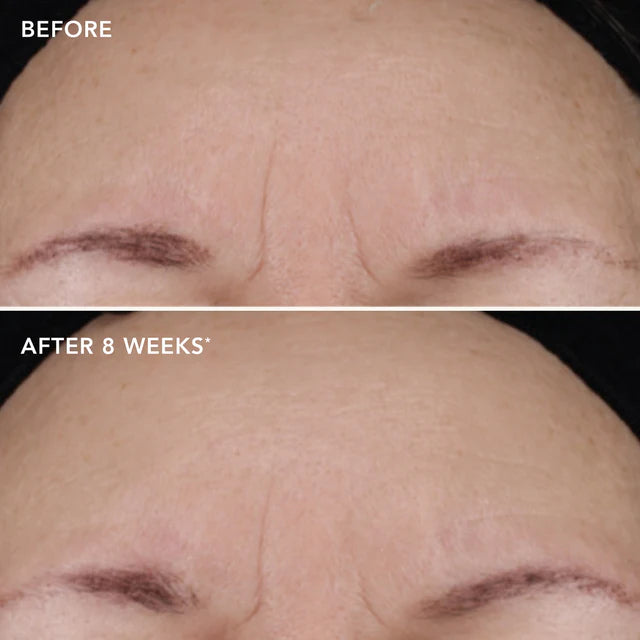 AGELESS+ Retinol Repair Crème 0.3% Retinol Complex